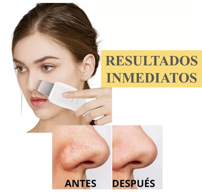 DERMASONIC PEELING ULTRASÓNICO LIMPIEZA FACIAL  50 % DE DESCUENTO🏷️